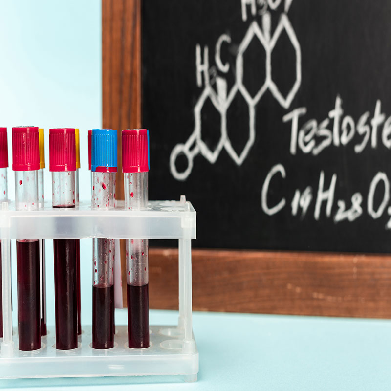 Testosteron 